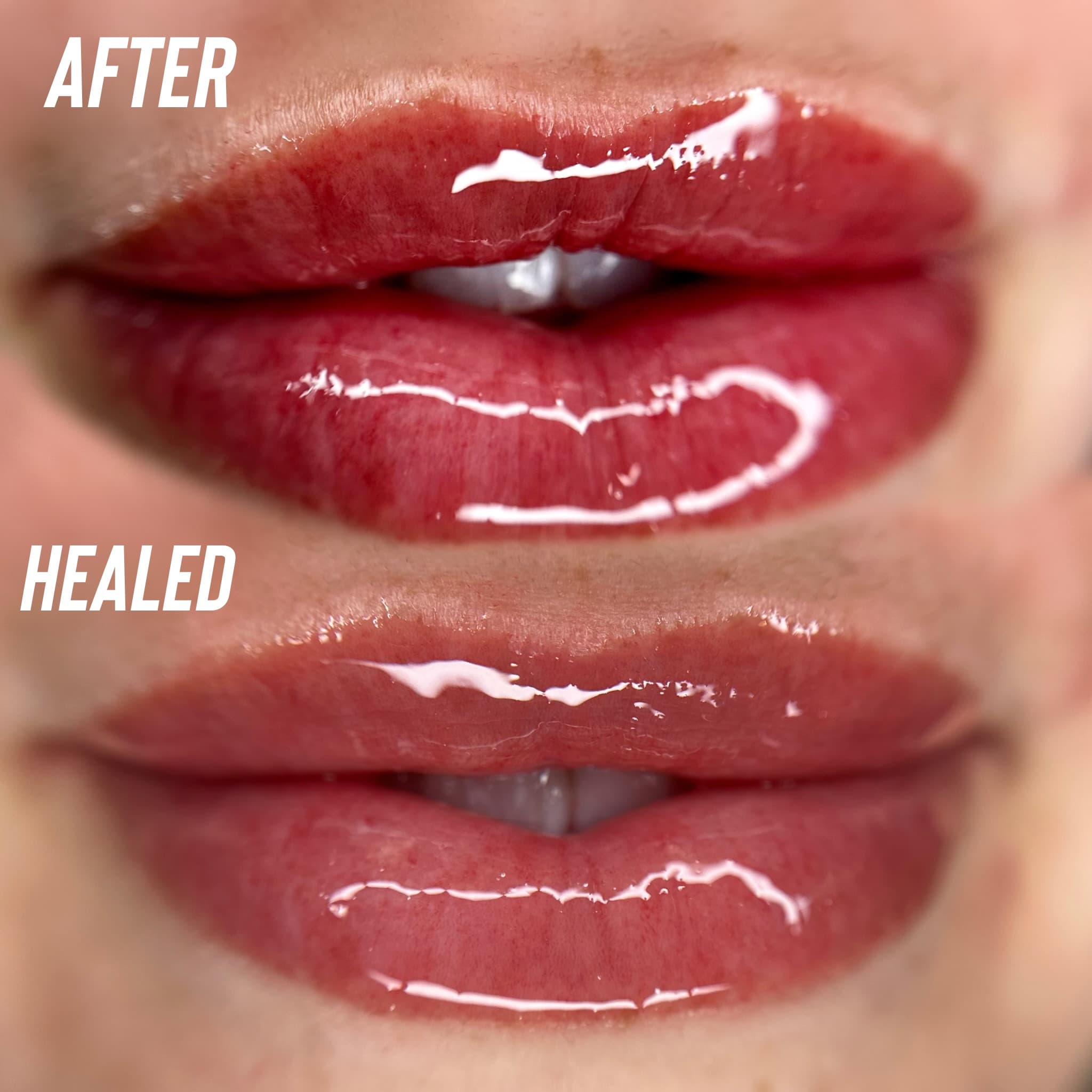 Lip Blush - Healed Perfection